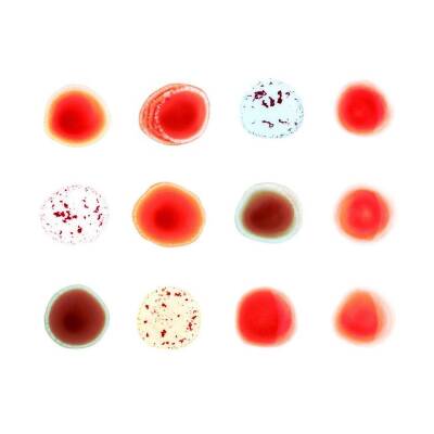 Gabriel Peter - And I´ll Scratch Yours (Del. Edt.)