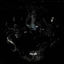 Nibiru - Anamorphosis